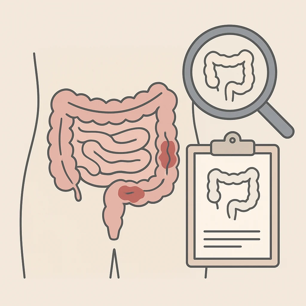 maladie de Crohn diagnostic